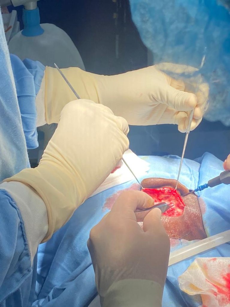 Humanitarian Surgery